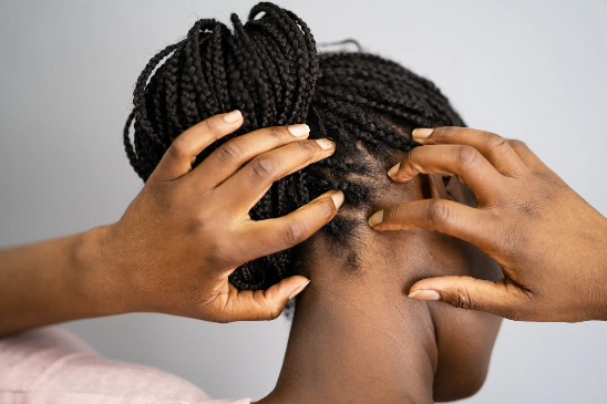 Itchy Scalp While In Braids? Proven Techniques To Soothe And Maintain Your Style