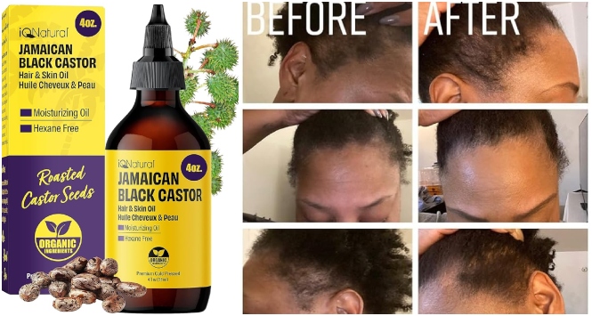 IQNATURAL Jamaican Black Castor Oil – For Hair & Skin