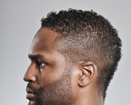 Micrografting: What Every Man Should Know About This Hair Transplant Technique