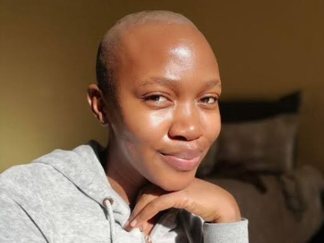 How Black Women With Alopecia Use Beauty Routines To Celebrate Identity And Strength