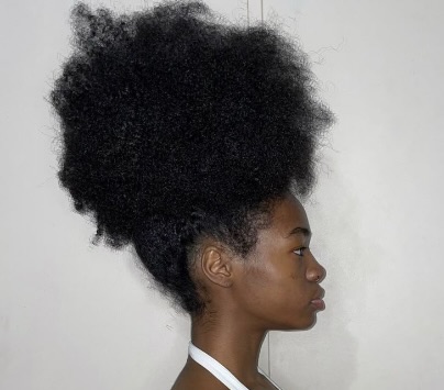 How To Regrow A Frontal Hairline: The Ultimate Guide To Restoring Stronger, Healthier Edges