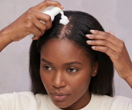 More Black Women Are Using Minoxidil: Here’s Why The Hair-Growth Treatment Is Gaining Attention